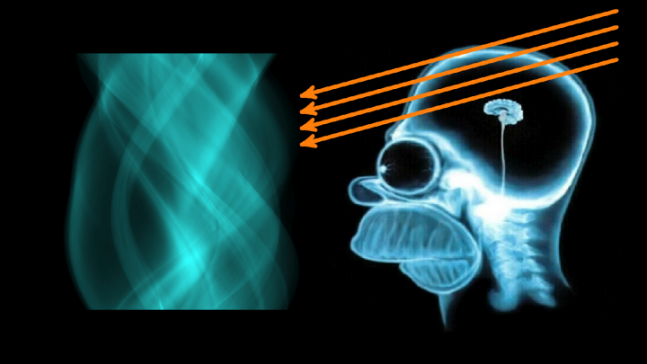 DD 2023-08-05 01 Wie funktioniert ein CT? (Computertomographie, Radon-Transformation)